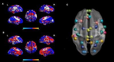 Different Functional Network Connectivity Patterns in Epilepsy: A Rest-State fMRI Study on Mesial Temporal Lobe Epilepsy and Benign Epilepsy With Centrotemporal Spike